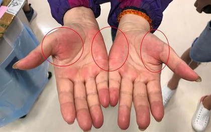 Nếu thường xuyên có 7 cảm giác này, rất có thể nhiều bệnh ung thư đang "thách thức", bạn cần đi khám ngay!