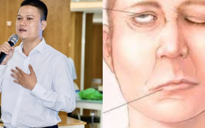 Nhà sáng lập thương hiệu Cà Mèn qua đời ở tuổi 34 vì đột quỵ: Căn bệnh tăng cao khi trời lạnh, có 4 dấu hiệu nhận biết sớm nhiều người bỏ qua