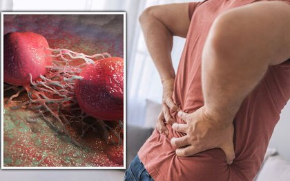 Ngày càng nhiều nam giới mắc ung thư tuyến tiền liệt: Thấy những dấu hiệu này thì làm ơn đừng bỏ qua