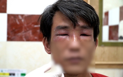 Kiến ba khoang lại tấn công người TP.HCM, bác sĩ cảnh báo chữa trị bằng 'mẹo'