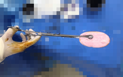 Bé gái 12 tuổi ở TP.HCM phải đi cấp cứu vì nhét xà phòng vào vùng kín lúc đang tắm