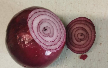 Hành tây có 4 công dụng thần kỳ, ai không biết thì rất thiệt