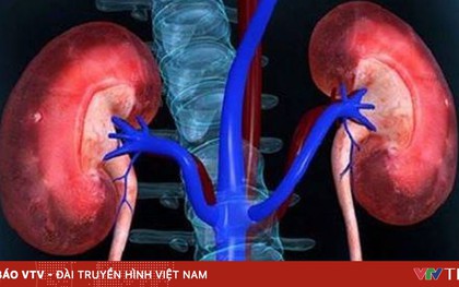 Điều trị thành công bệnh nhi mắc toan hóa ống thận type I hiếm gặp