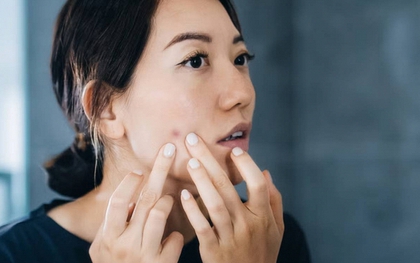 Cứ đổ lỗi cho stress, ai ngờ nguyên nhân mệt mỏi, da xấu, tóc rụng là do thiếu dưỡng chất này: 8 dấu hiệu phụ nữ rất dễ gặp