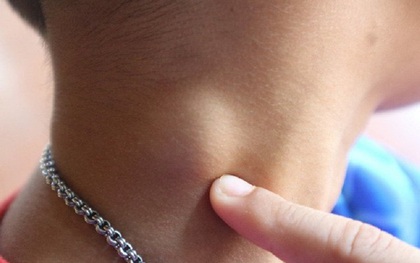 Đi khám được chẩn đoán u lành, sang nơi khác phát hiện có nhiều nhân ung thư tuyến giáp