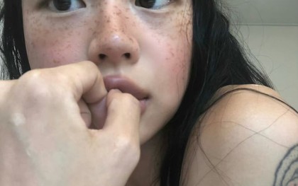 Cảnh báo: Nữ giới có 4 vùng này trên cơ thể càng "đen" chứng tỏ tử cung càng chất nhiều độc tố