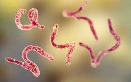 Sụt cân kéo dài vì nhiễm cả ổ giun tóc