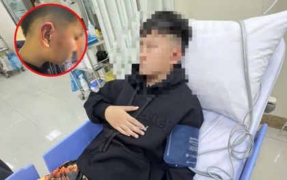 Hà Nội: Bé trai 12 tuổi nghi bị bố của bạn tát, đánh đến choáng váng, hé lộ nguồn cơn