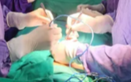 Nhập viện muộn, thanh niên mất một bên tinh hoàn