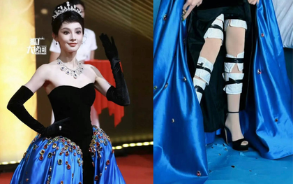 Cực hình đi thảm đỏ của mỹ nhân Cbiz