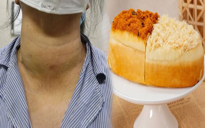 5 thực phẩm người có u tuyến giáp không nên ăn dù thèm đến mấy