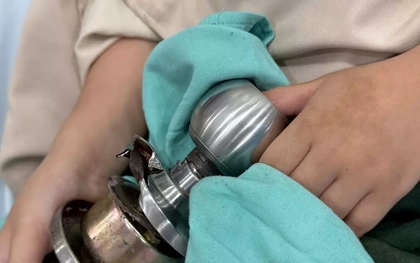 Bệnh nhi ‘ôm’ ổ khóa nhập viện cấp cứu, bác sĩ phát cảnh báo khẩn