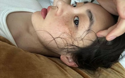 7 "tín hiệu SOS" khi cơ thể thiếu collagen trầm trọng, ăn thêm 5 món để bổ sung gấp!