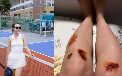 Dân văn phòng đổ xô chơi pickleball: "Đau nhưng tôi vẫn ham"