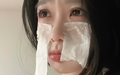 5 thứ KHÔNG BAO GIỜ được bôi lên mặt vì tàn phá làn da: Bất ngờ khi nhiều chị em tưởng đó là mẹo làm đẹp