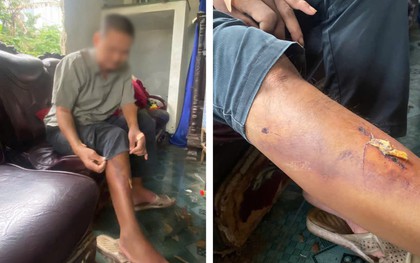 Xác định nhóm học sinh hành hung người đàn ông say rượu trong đêm ở Huế