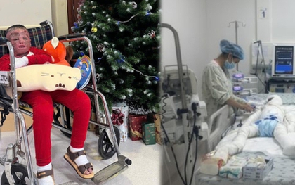 96 ngày giành sự sống của cậu bé 5 tuổi bị cha đốt xăng bỏng đến 80%: “Phép màu từ nghị lực phi thường”