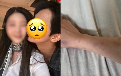 Công bố kết quả điều tra vụ nam diễn viên ngoan hiền bị tố đánh đập, “đào mỏ” bạn gái hàng trăm triệu