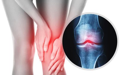 Trời lạnh, đau cơ xương khớp tăng: Chủ động chăm sóc để giảm đau