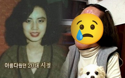 "Thảm họa thẩm mỹ" cuồng loạn tự tiêm dầu ăn vào mặt, từ mỹ nhân xinh đẹp cuối đời ra đi trong đau đớn