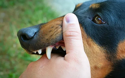 Người đàn ông 51 tuổi tử thương tâm sau khi bị chó "lạ" cắn