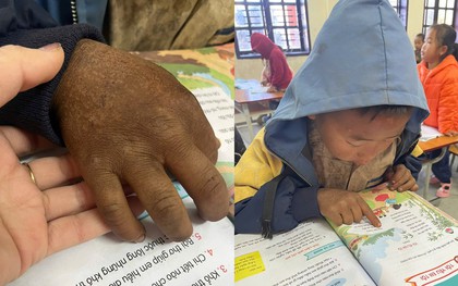 Hình ảnh bàn tay nứt nẻ của cậu bé 8 tuổi vùng cao khiến triệu người nghẹn lại