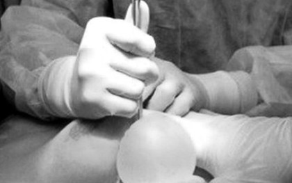 Người phụ nữ 30 tuổi bị hoại tử ngực vì tiêm chất làm đầy