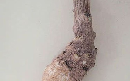 Cảnh báo ngộ độc, phản vệ nguy hiểm từ thực phẩm, rượu ngâm