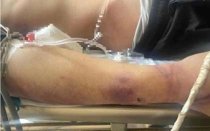 Sau khi thiếu niên tử vong: Trung tâm CTXH đã đưa khoảng 80 học viên lên 3 ô tô, chở đi nhiều nơi