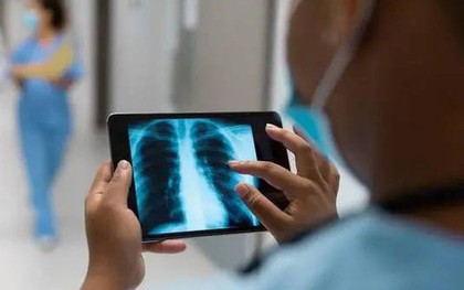 Những người có "phổi sạch" thường có 5 đặc điểm. Nếu bạn có 4 trong số đó, thì xin chúc mừng!