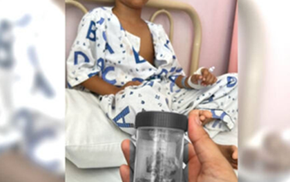 Bé trai 12 tuổi mất 12 chiếc răng 1 lúc vì thói quen nhiều trẻ mắc phải