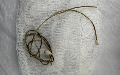 Dây sạc điện thoại nằm trong bàng quang của nam sinh sau khi học theo clip trên mạng