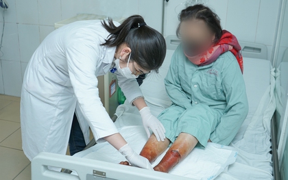 Người phụ nữ tổn thương nghiêm trọng hai bàn chân vì ngâm nước giữ ẩm bằng loại bột không rõ nguồn gốc