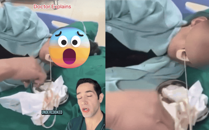 Clip kinh hoàng về con vật dài cả mét được kéo ra từ miệng người phụ nữ, bác sĩ khẩn cấp cảnh báo lỗi nấu ăn nguy hiểm