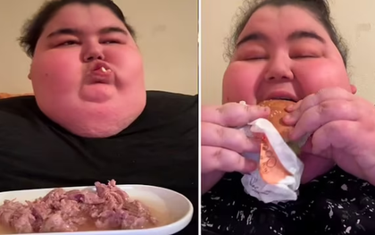 'Thánh mukbang' qua đời ở tuổi 24 do bệnh béo phì