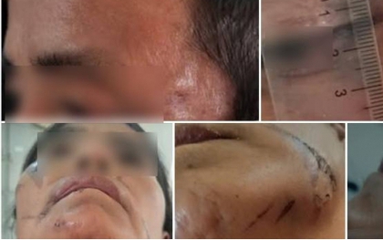 Công an Điện Biên điều tra vụ bắt giữ người trái pháp luật vì nghi bị bỏ bùa