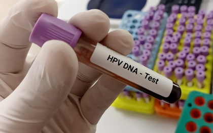 Có cần xét nghiệm virus HPV trước khi tiêm vắc xin HPV không?