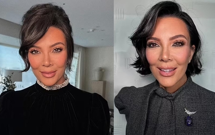 Loạt ảnh mới của mẹ Kim Kardashian gây sốt: Nhiều người đặt nghi vấn "cải lão hoàn đồng" giống Lindsay Lohan