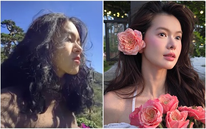 Yên Đan - “công chúa của SOOBIN”: Ngỡ ngàng diện mạo trước khi phẫu thuật