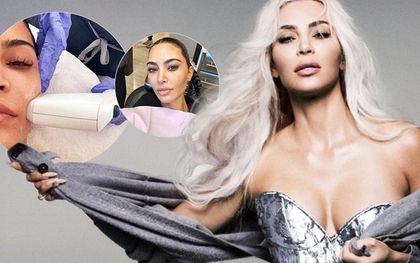Sao Hollywood chi gần 120.000.000VNĐ/lần "bơm" collagen, không ngớt lời ca ngợi đây là phương pháp giúp săn chắc da bậc nhất