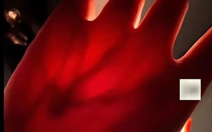 Cô gái đăng ảnh mình chiếu đèn pin vào tay, cư dân mạng phát hiện điều bất ổn