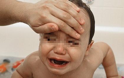Trẻ em đang gặp những vấn đề sức khỏe nào thì không nên tiêm vắc xin sởi?