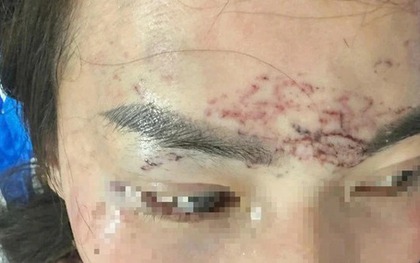 Khởi tố vụ bắt người phụ nữ đem về xăm, cắt tóc và đánh đập gây chấn động dư luận ở Cà Mau