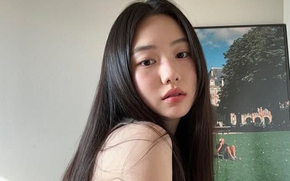 Chăm ăn món này vài tuần, tốn chưa đến 20k mà da chắc khỏe, sáng rực như đèn pha!