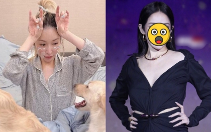 Sốc nặng với "gương mặt rắn" biến dạng của nữ ca sĩ hạng A sau vụ bị chó cắn đến hủy dung
