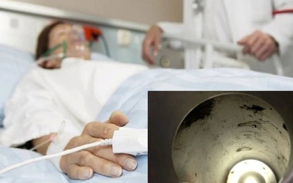 Trung Quốc: Dùng cốc giữ nhiệt bị gỉ, người đàn ông tử vong nghi do ngộ độc chì