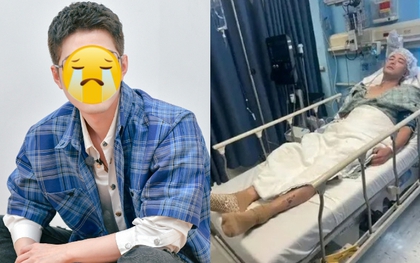 Chi tiết vụ tai nạn xe tải kinh hoàng khiến nam diễn viên khổ nhất showbiz bị cán nát chân