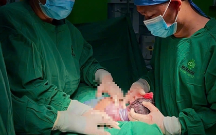 Bé gái ở Quảng Nam chào đời với dây rốn quấn quanh cổ đến 4 vòng