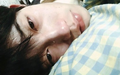 Soi làn da ra ngay bệnh gan: Thấy 3 kiểu “đỏ, đen, vàng” này đi khám nhanh còn kịp!