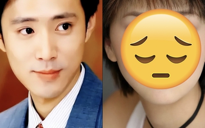 Nữ diễn viên gặp tai nạn biến dạng gương mặt, bạn trai ra 1 quyết định khiến cả showbiz sững sờ